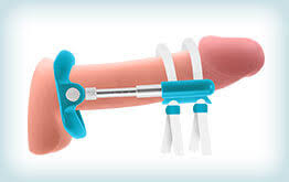 penis traction device in situ